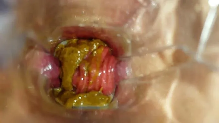 Speculum Play and Filled Pussy part 1 [FullHD 1080p]  2018 (Anna Coprofield) Extreme Scat, Scatology