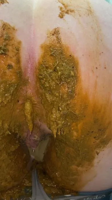 Extreme jean accident [UltraHD 2K]  2020 (Sexandcandy18) Defecation, Scatology