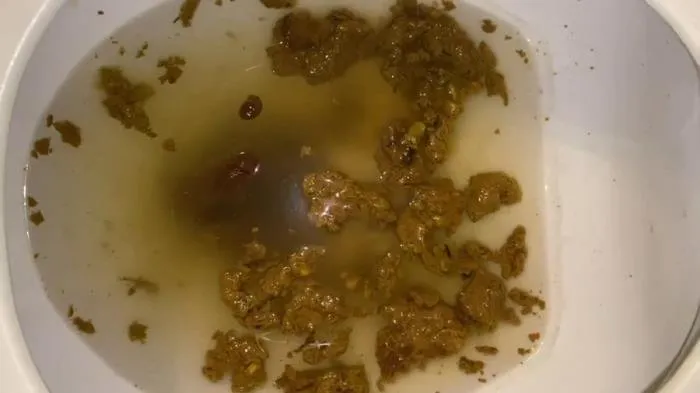 Lemon Water Detox [FullHD 1080p]  2021 (WatchMarleyPoop) Scatology, Defecation