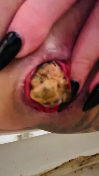 Look at that prolapse! [UltraHD 4K]  2025 (Taylor Nicole) Big Pile, Shit