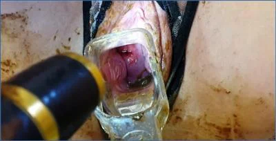 Anna Coprofield's Speculum Play During Menstruation with Farting and Toilet
