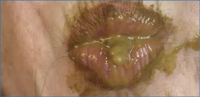 Dirtygardengirl Stars in Shit Mistress Upclose Personal 1 FullHD Scatting