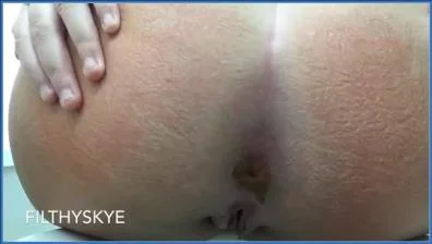 Filthy Skye's Extreme Anal Gaping and Scat Play